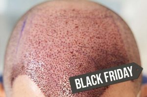 Pós-Graduação em MEDICINA CAPILAR