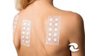 Workshop Teste de Contato (Patch e Prick test)