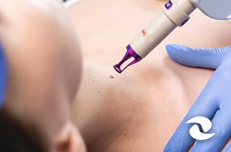 Pós-Graduação em CIRURGIA DERMATOLÓGICA