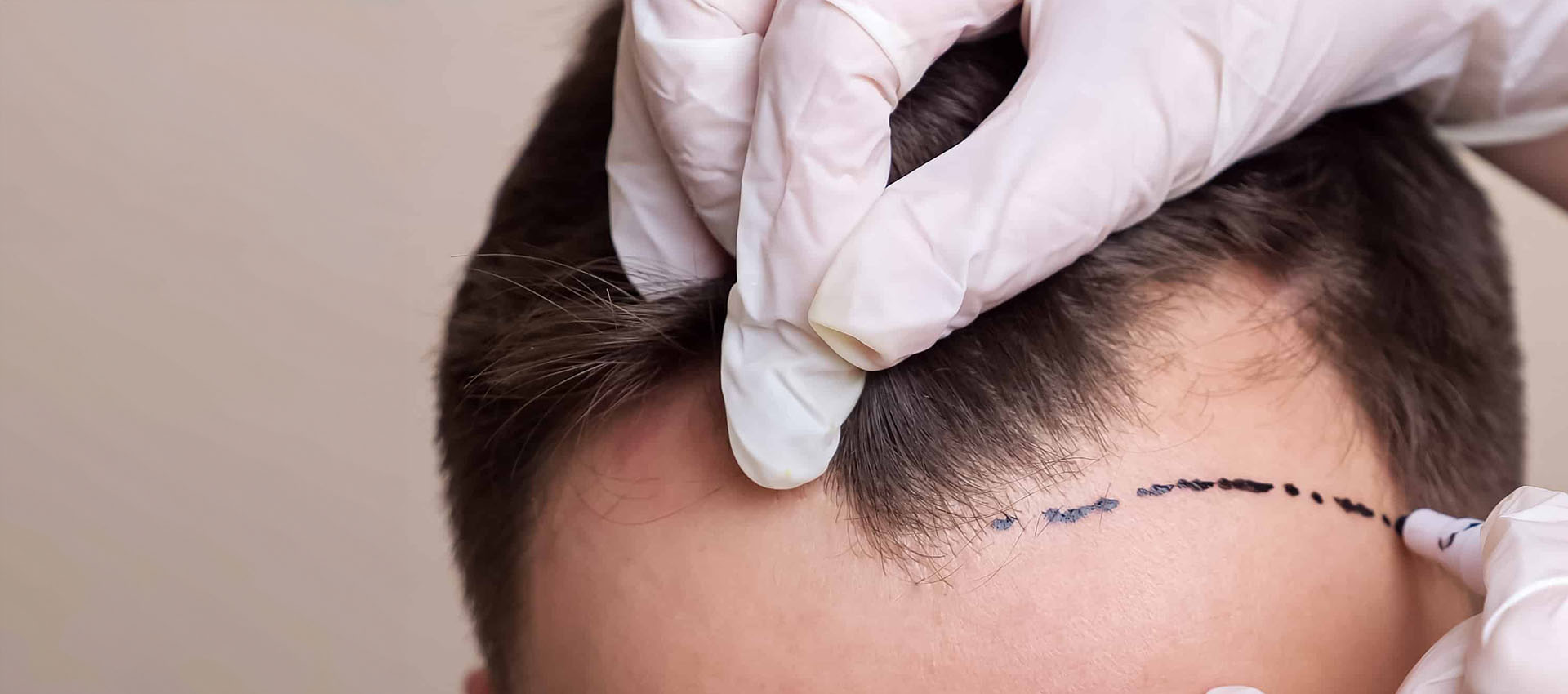 curso de tricologia capilar