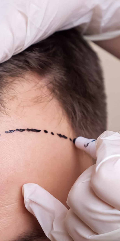 curso tricologia capilar