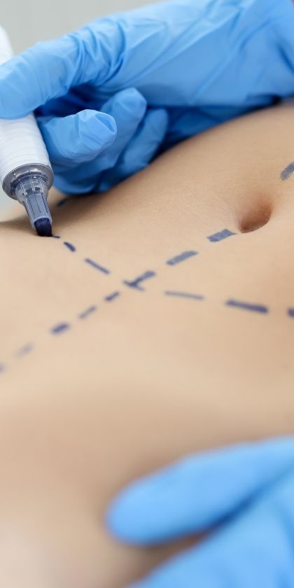 curso lipoplastia
